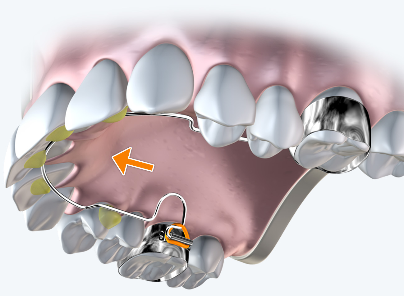 Patientenfreundliches Design