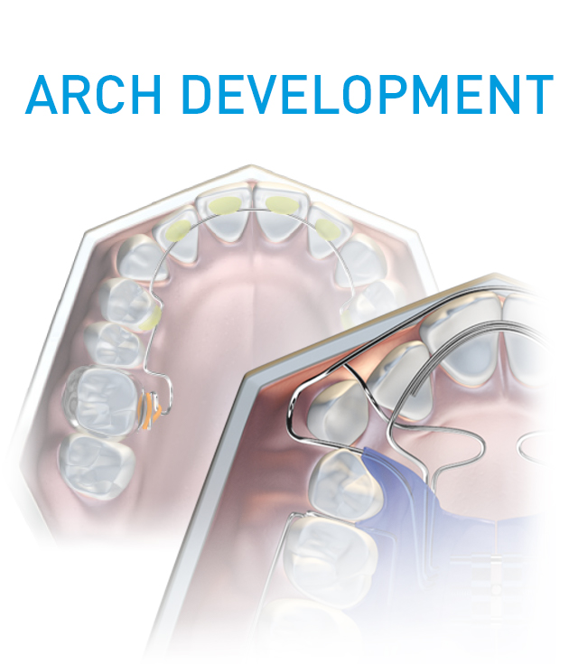 Arch Development