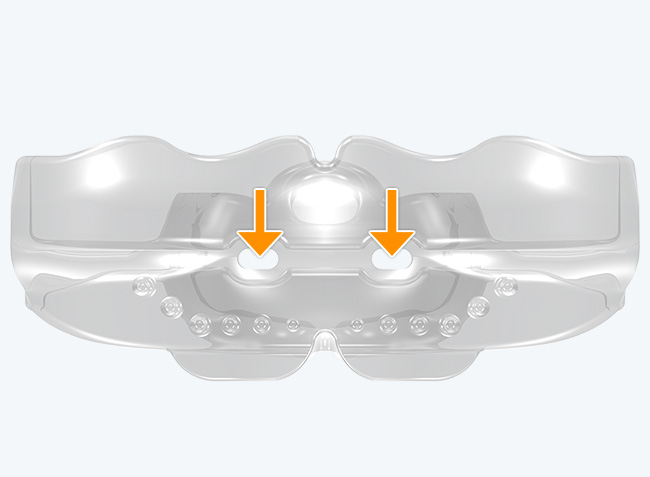 myobrace　Medium The Myobrace® System