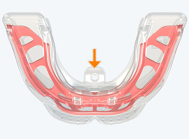 Posicionador lingual