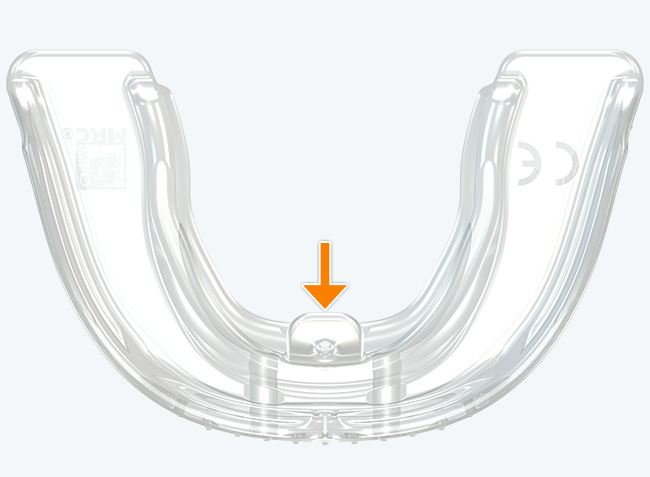 Языковой выступ