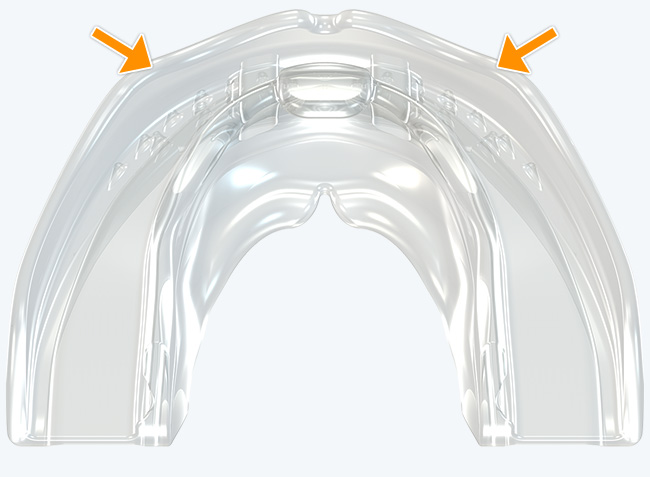 Robust anterior arch form