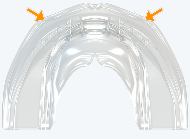 Robust anterior arch form