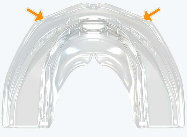 Forma robusta del arco anterior