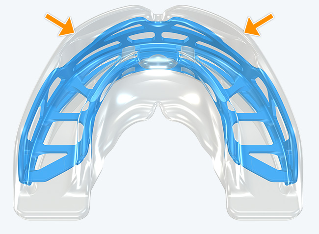 Robust anterior arch form