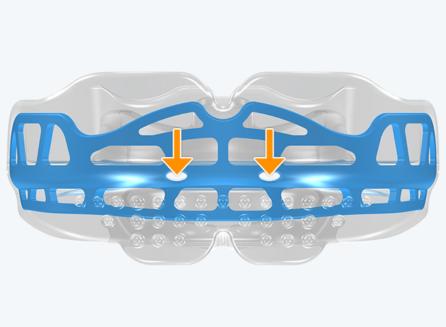 De petits orifices pour le passage de l'air