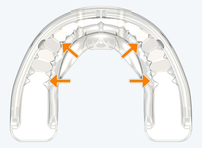 Ranuras para los dientes