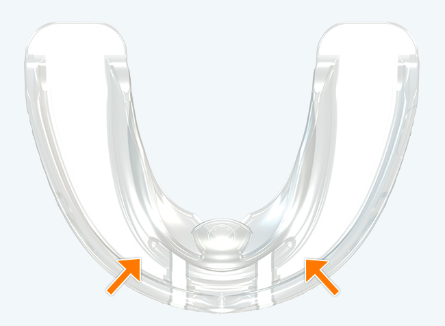 Tooth channels