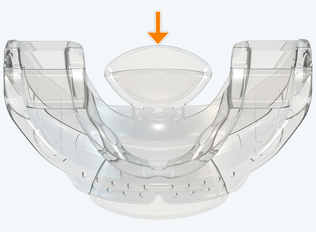 Tongue press tube