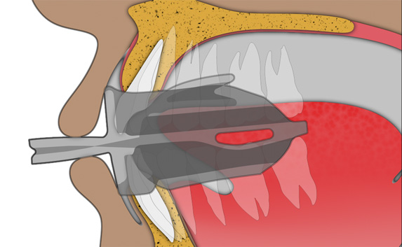 Lippenübung: Schritt 2