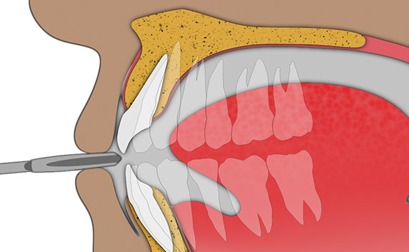 Exercício labial: Passo 2