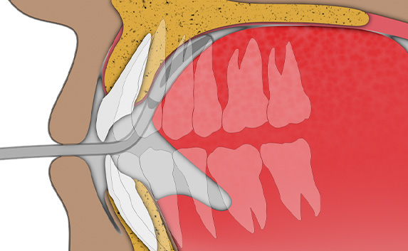 Tongue Exercise: Step 2