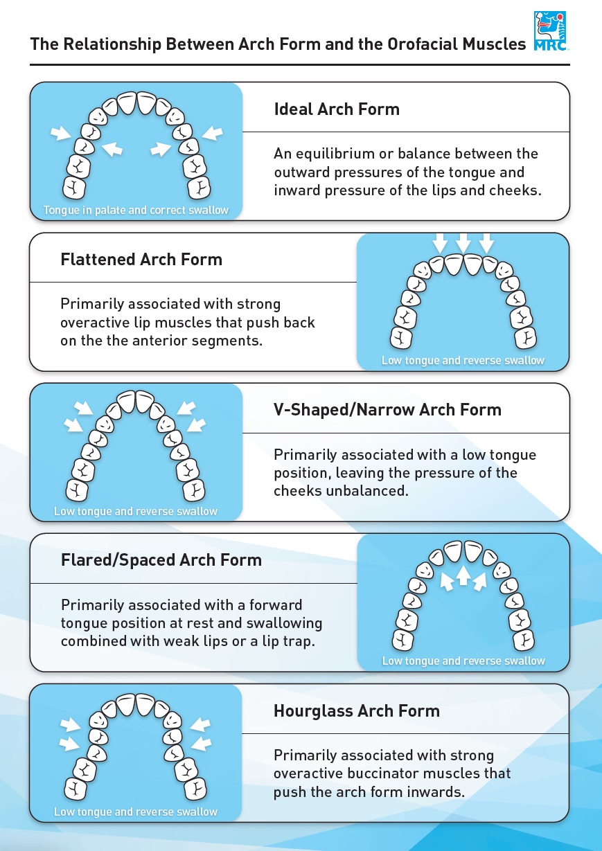 Arch Form & Orofacial Muscles Infographic!